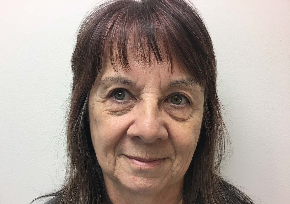 Hydrafacial Before and After | Montilla Plastic Surgery