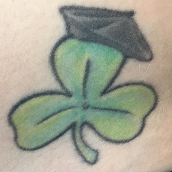 Laser Tattoo Removal Before and After | Montilla Plastic Surgery 