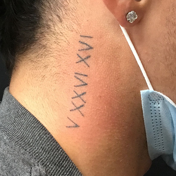 Eliminate Your Old Ink with Laser Tattoo Removal McGuiness Dermatology Plastic Surgery Aesthetic Specialists #57 Eliminate Your Old Ink with Laser Tattoo Removal McGuiness Dermatology Plastic Surgery Aesthetic Specialists